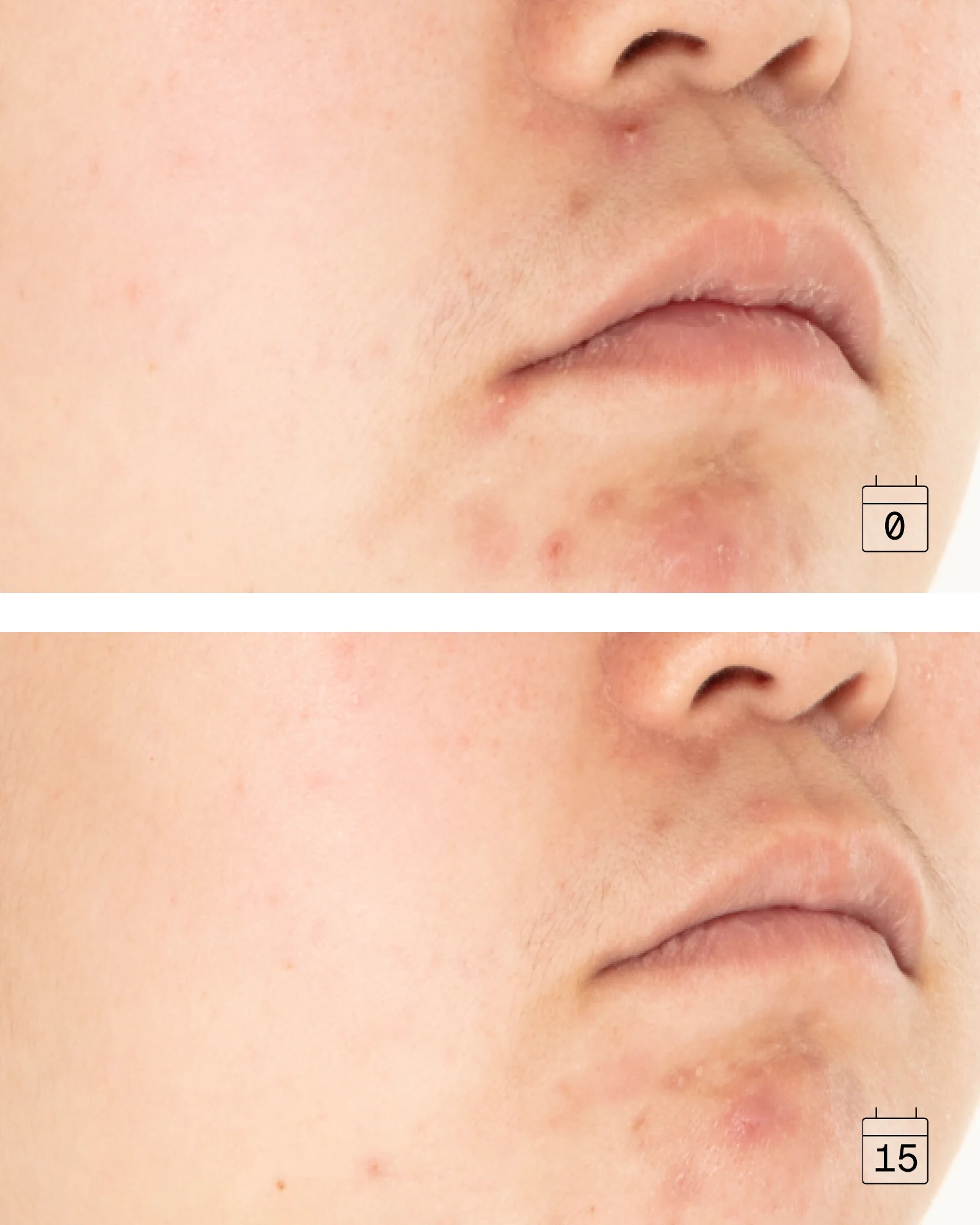 16-in-1 Anti-Aging Cream for Oily & Combination Skin - Image 3