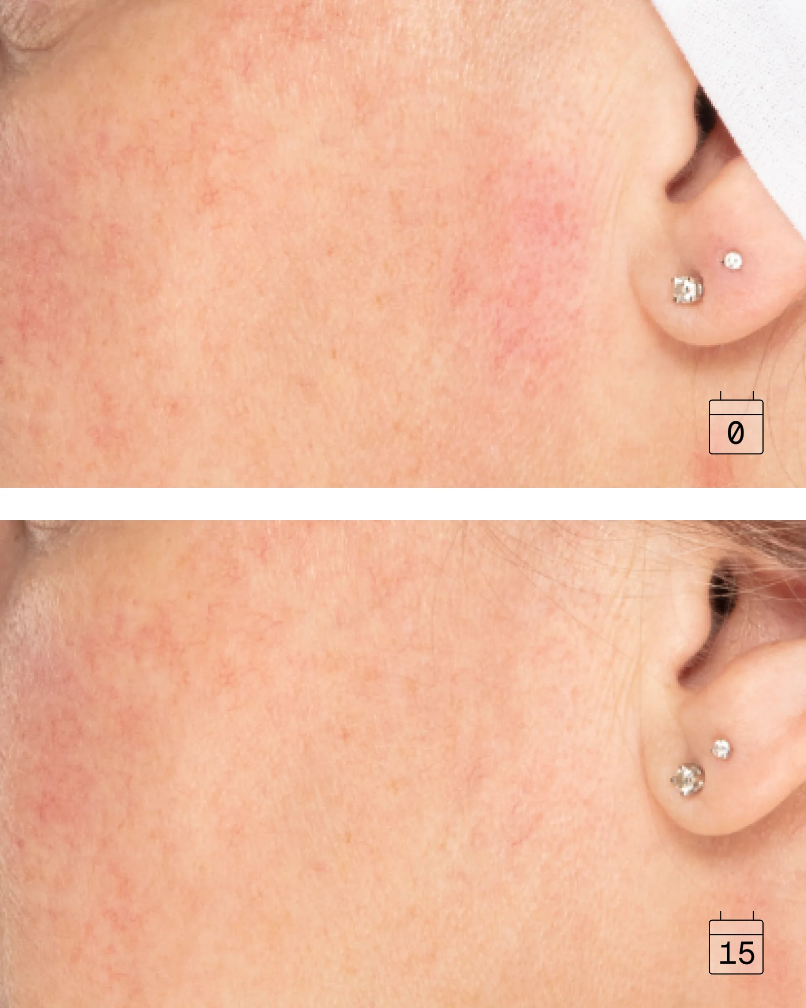 16-in-1 Anti-Aging Cream for Sensitive Skin – Fragrance-Free - Image 4