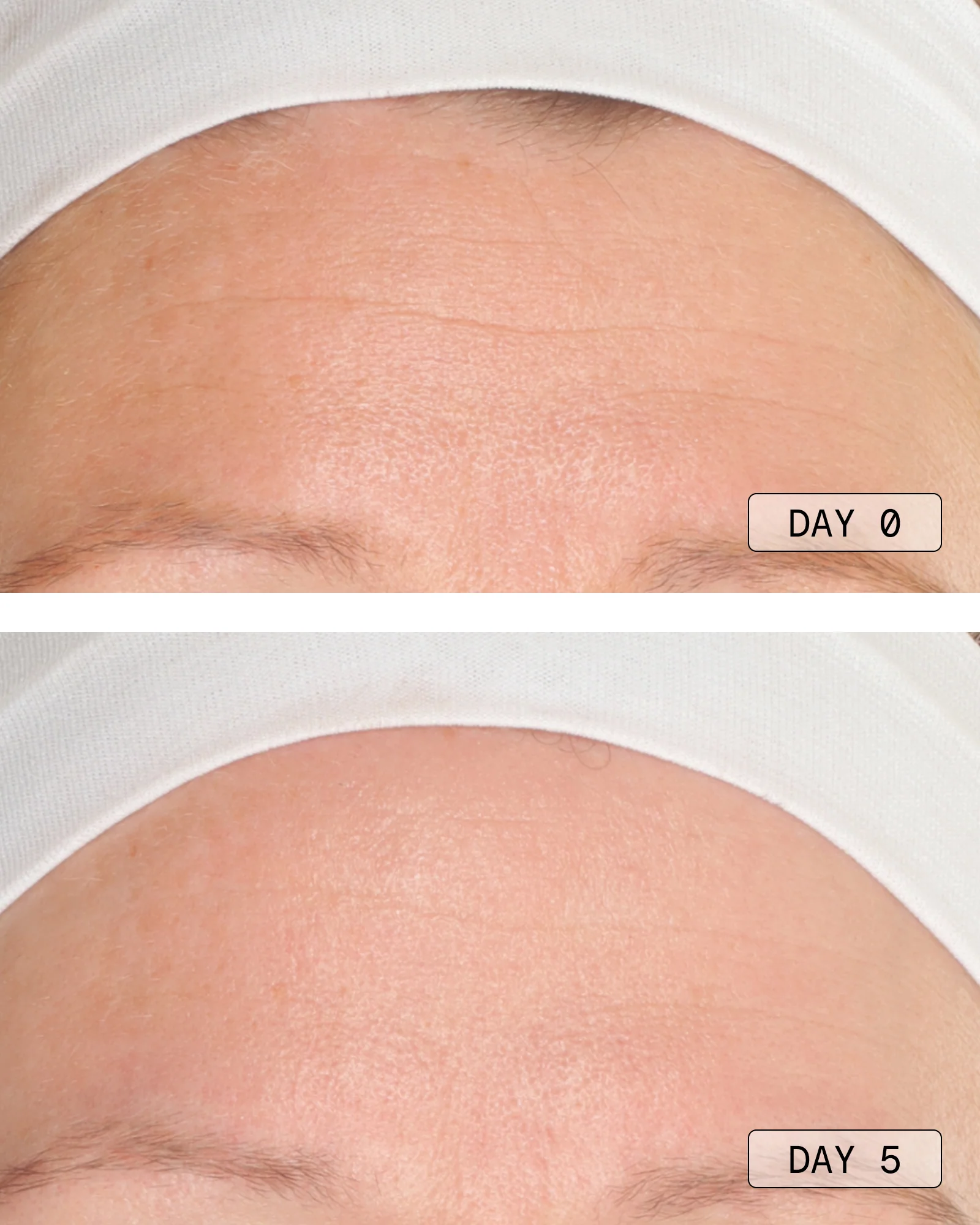 Boost Argireline® | Anti-Wrinkle Perfecting Serum - Image 9