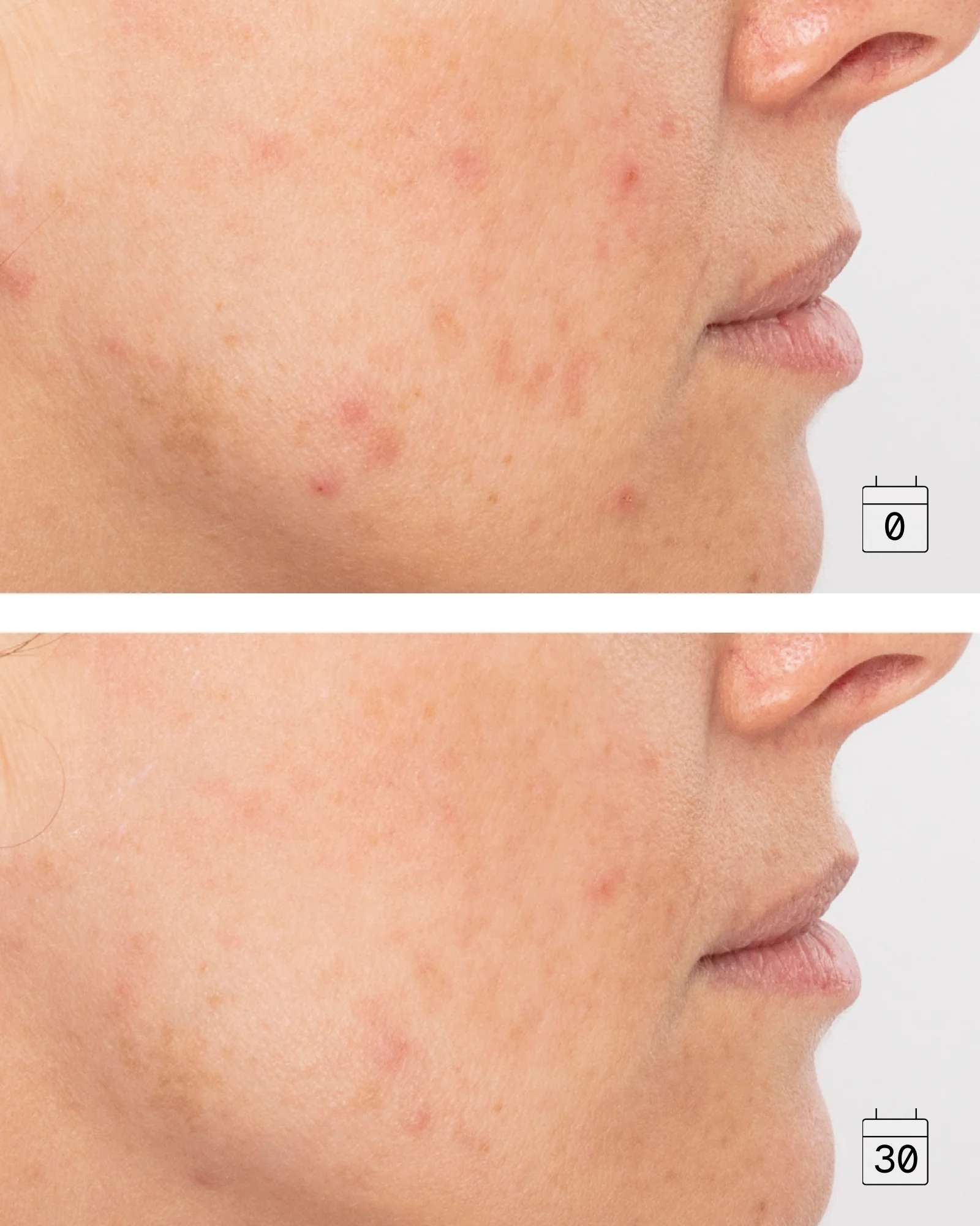 Boost Vitamin C | Radiance and Even Skin Tone Serum - Image 3