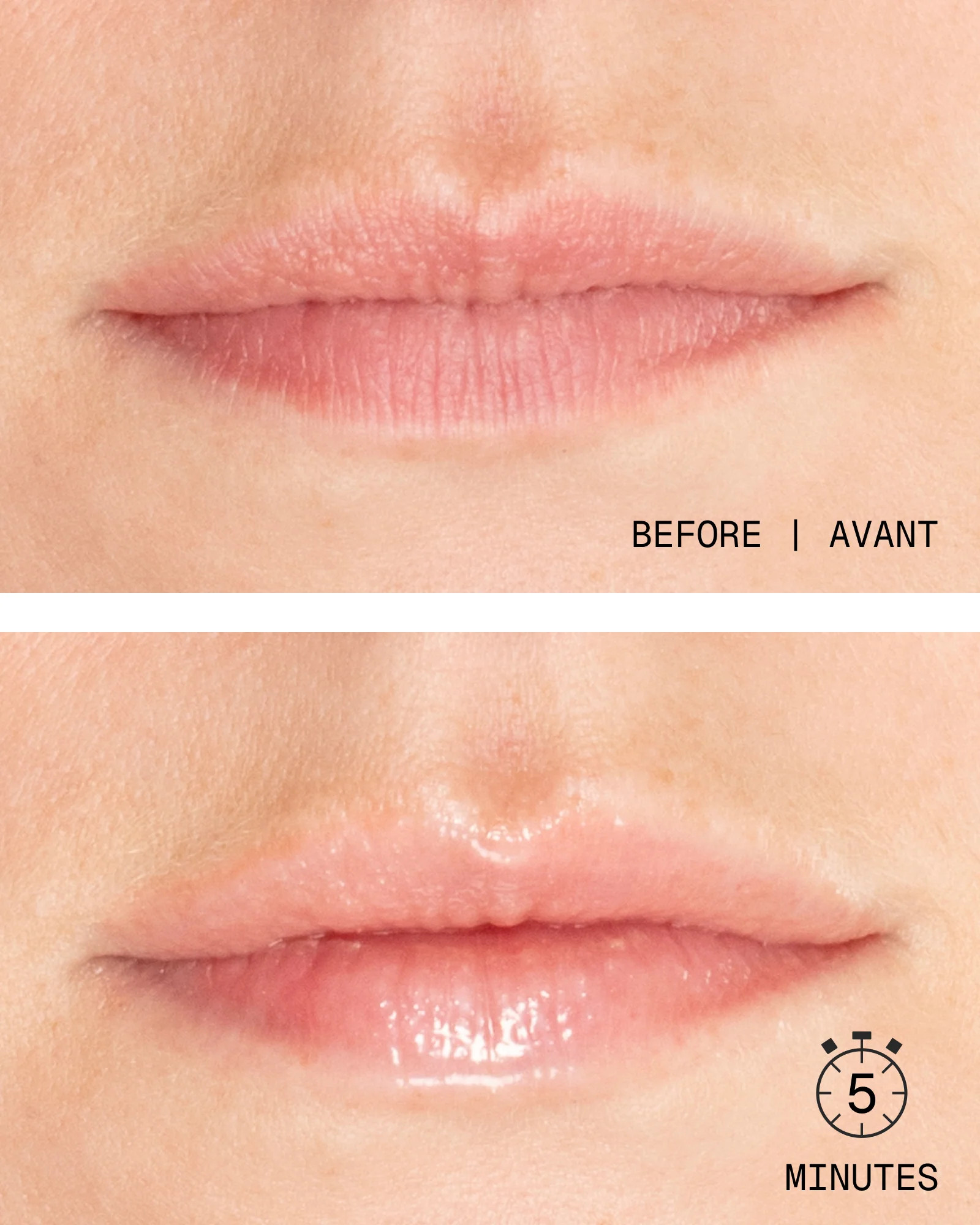 Injection-Free Wrinkle & Lip Plumping Duo - Image 3