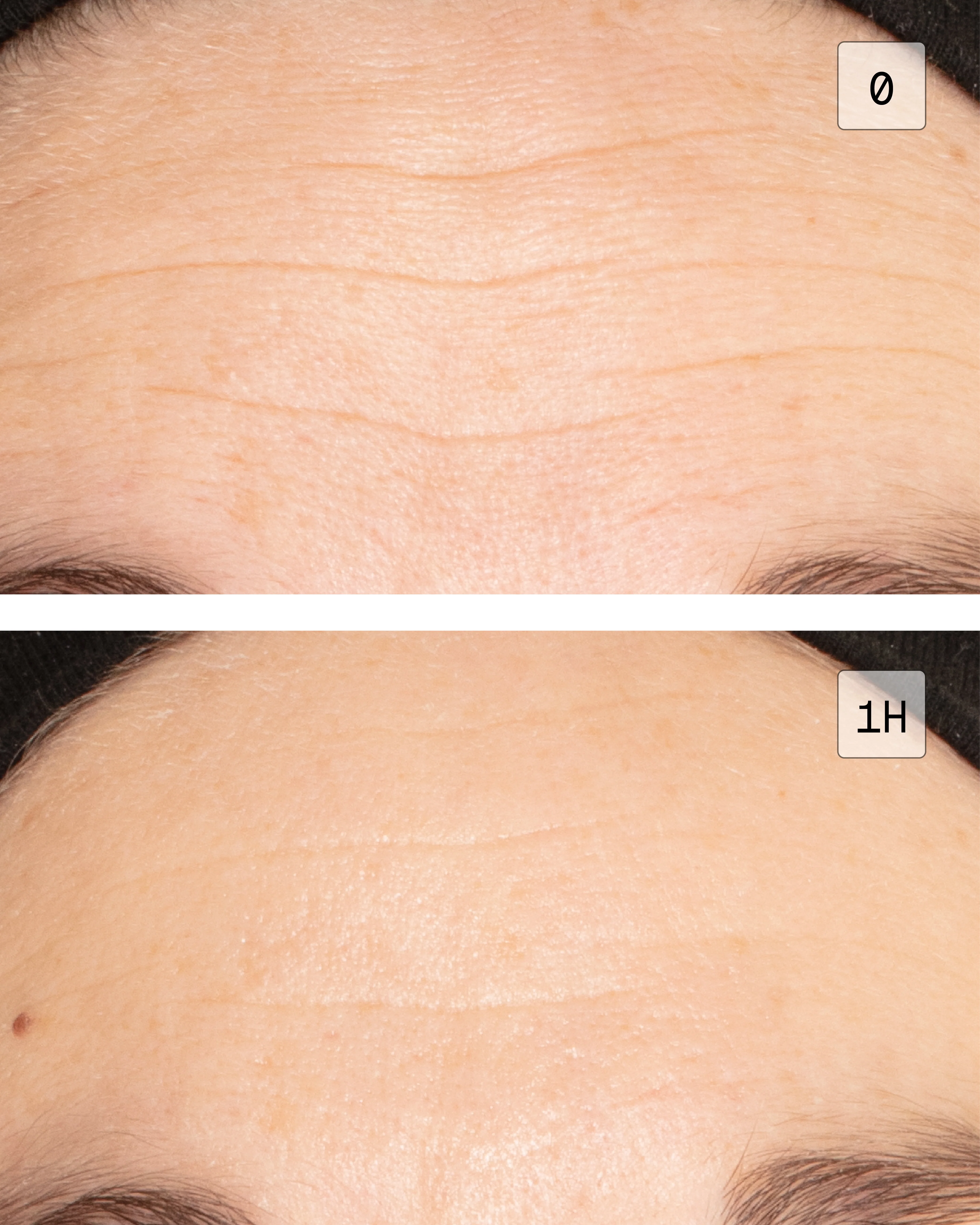 Injection-Free Wrinkle & Lip Plumping Duo - Image 5