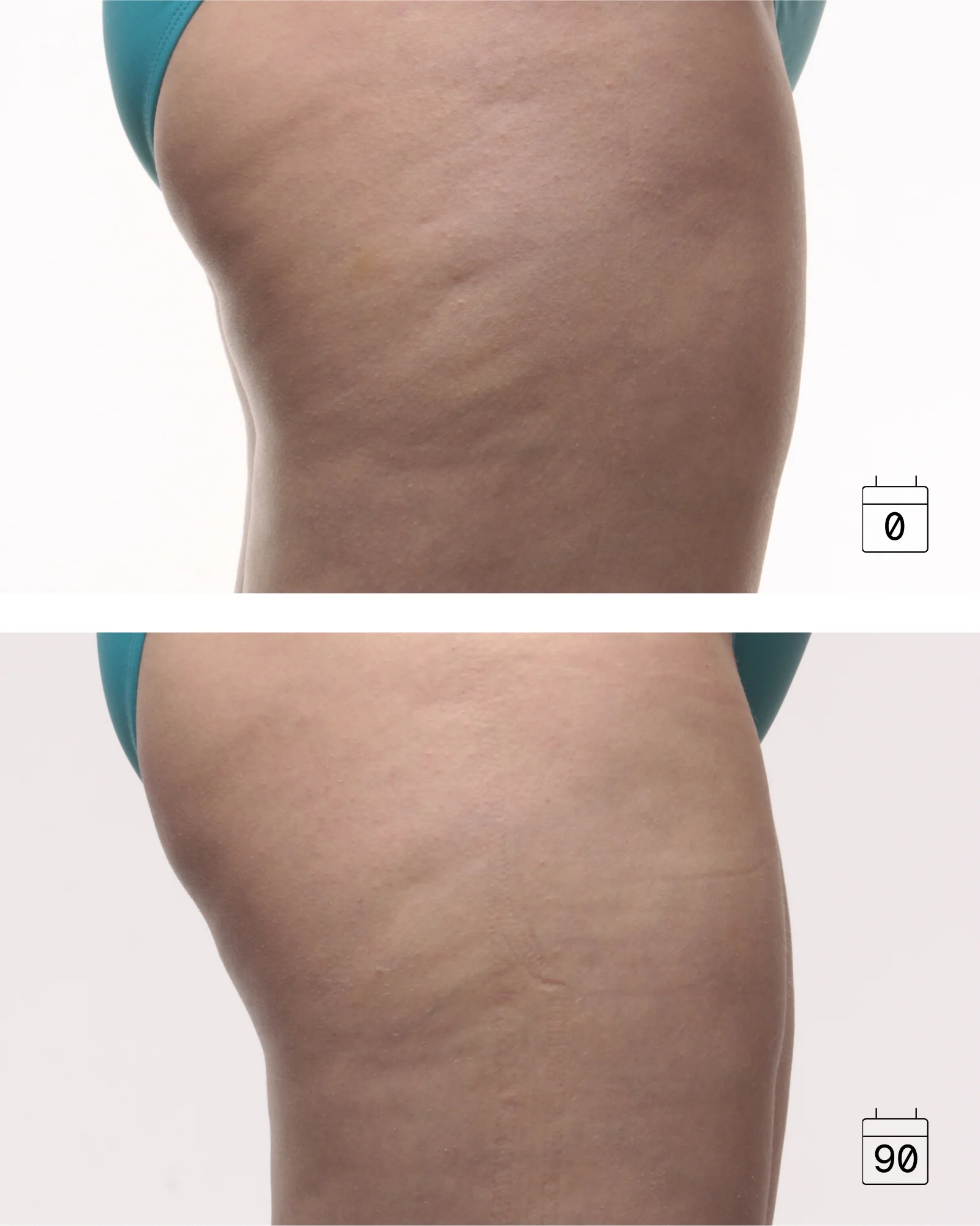 Profil Cellélite + | Anti-Aging Smoothing and Sculpting Gel - Image 3