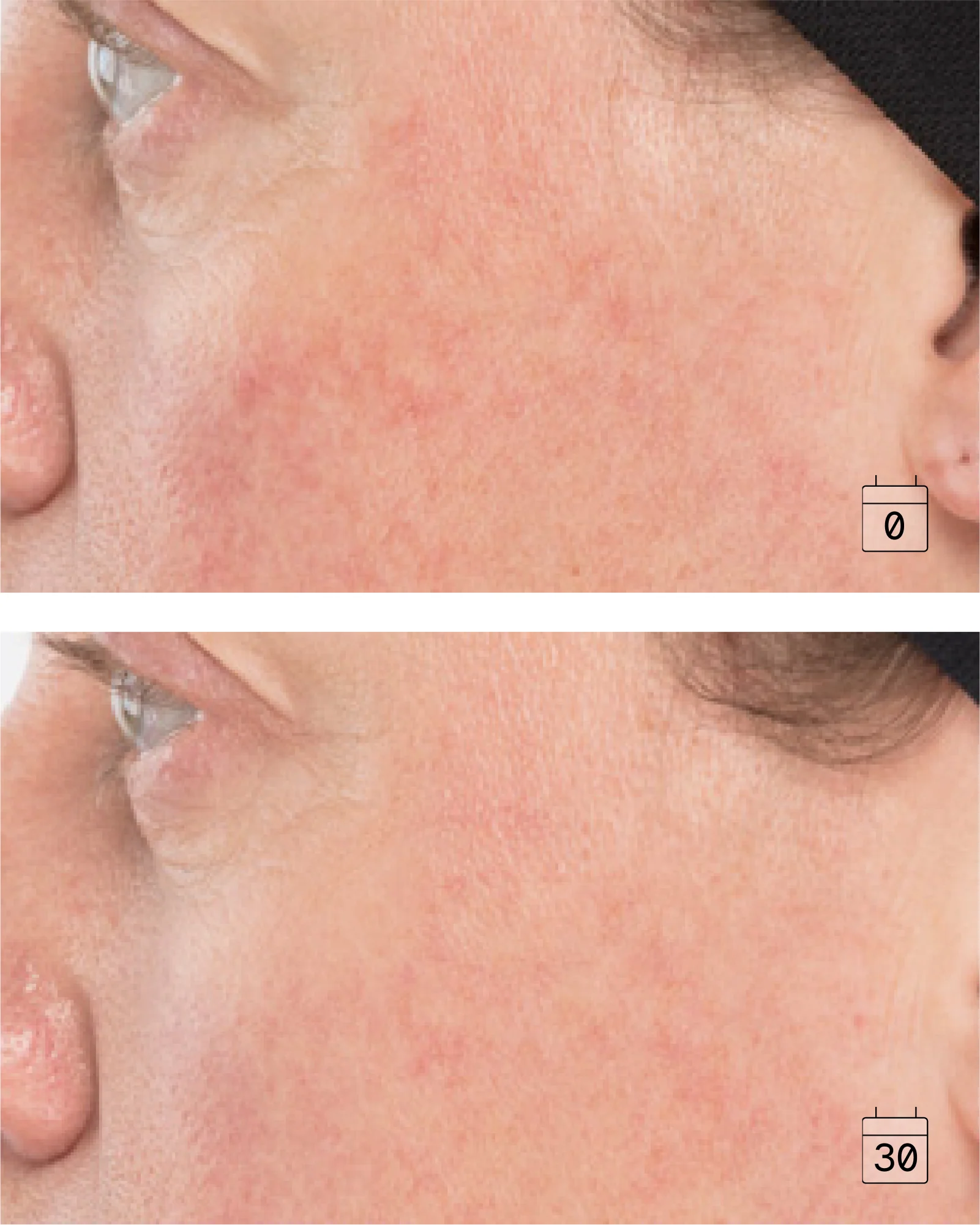 Ultime Comfort | Anti-aging Anti-redness Cream - Image 4
