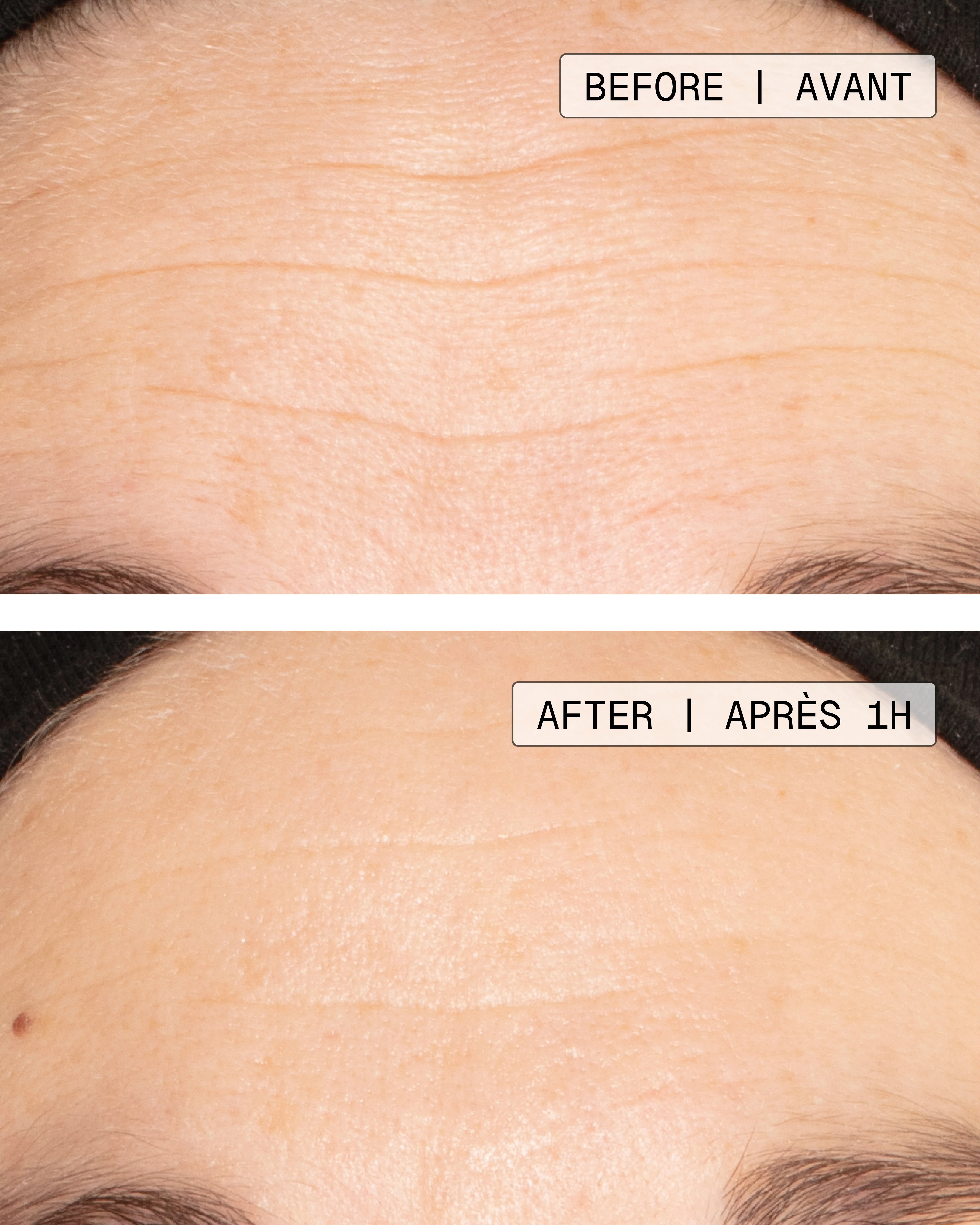 Ultime Expression+ | Deep Wrinkle Targeted Concentrate - Image 3