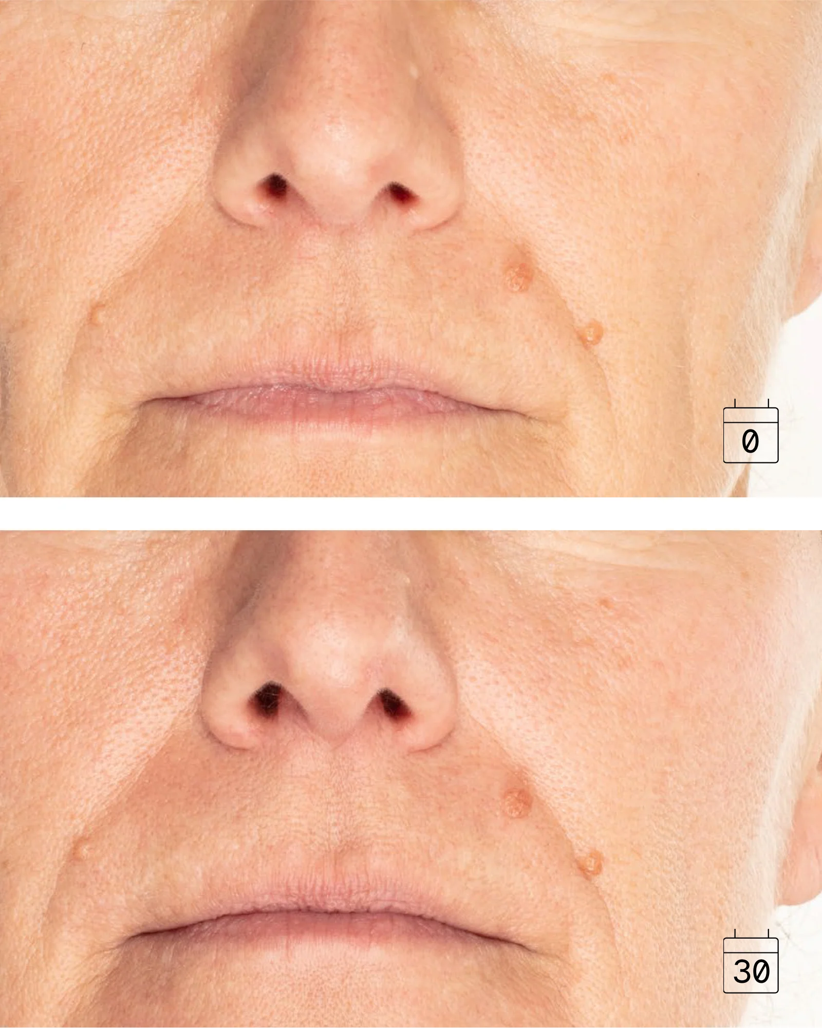 Ultime Hyperlift 4D | Anti-Gravity Lifting Serum - Image 3